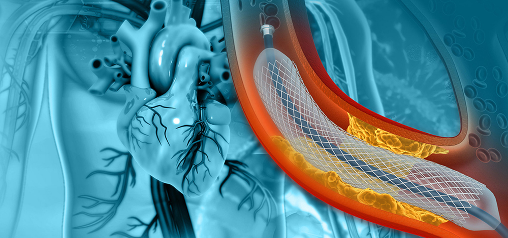 Interventional Suite Integrated Solution